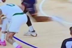 美國醫(yī)學(xué)專家：可以看到右小腿有震動(dòng) 這可能是跟腱撕裂的跡象